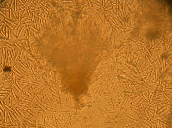 Рис. 3 - Cylindrocarpon destructans (Zinssm.) на разрушающихся  корнях Juniperus scopulorum (образец отобран в начале весны при температуре почвы = +2С)