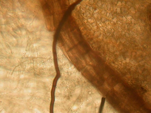 Рис. 2 - Rhizoctonia solani на поверхности нижней части стебля сфагнового мха, погруженного в субстрат (фото образца, отобранного на торфяннике при t – 0C). Рис. 2 - Rhizoctonia solani на поверхности нижней части стебля сфагнового мха, погруженного в субстрат (фото образца, отобранного на торфяннике при t – 0C).