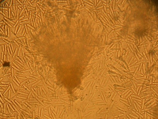 Рис. 3 - Cylindrocarpon destructans (Zinssm.) на разрушающихся корнях Juniperus scopulorum (образец отобран в начале весны при температуре почвы = +2С) Рис. 3 - Cylindrocarpon destructans (Zinssm.) на разрушающихся корнях Juniperus scopulorum (образец отобран в начале весны при температуре почвы = +2С)