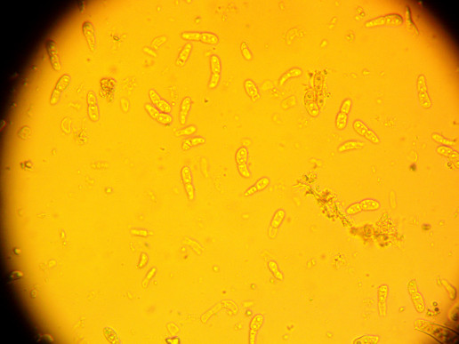 Рис.6В. Черная пятнистость на листьях роз (конидии)